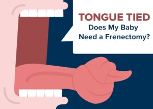 Des Moines dentist, Dr. Chad Johnson at Veranda Dentistry, discusses different types of frenums, how they can cause problems for your baby’s mouth, and treatment with frenectomy.