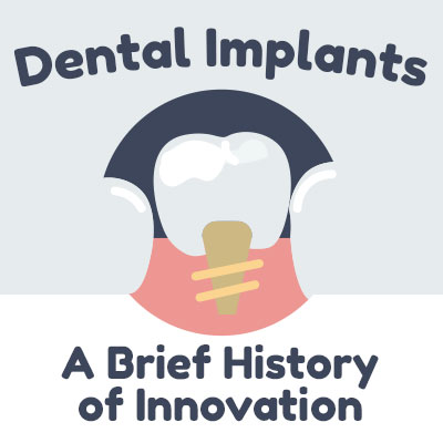 Des Moines dentists at Veranda Dentistry discuss dental implants and shares some information about their history.
