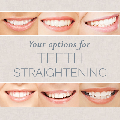 Des Moines dentists at Veranda Dentistry shares all you need to know about choosing the right teeth straightening option for you.